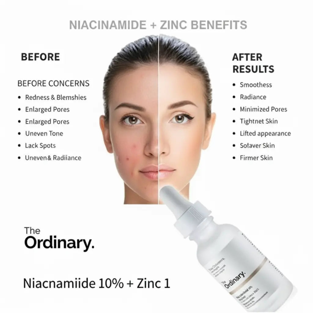 Ordinary Niacinamide 10% + Zinc 1% - 30ml
